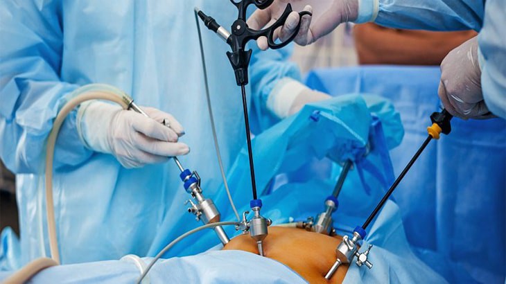 laparoscopy treatment up