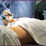 Laparoscopy Healthcare