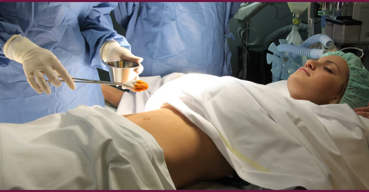 Laparoscopy Healthcare