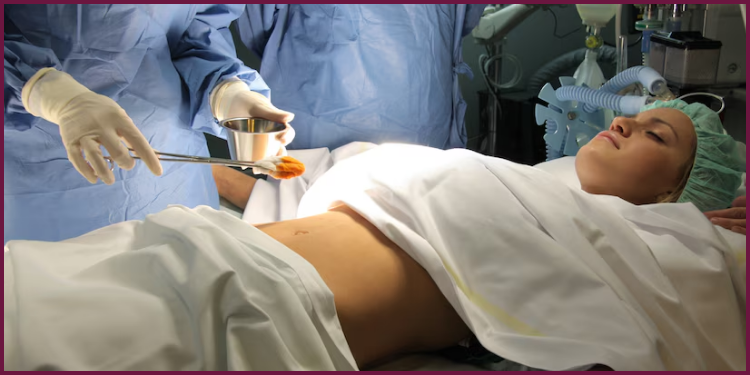 Laparoscopy Healthcare