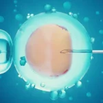 Second IVF Attempt