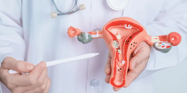 Endometriosis