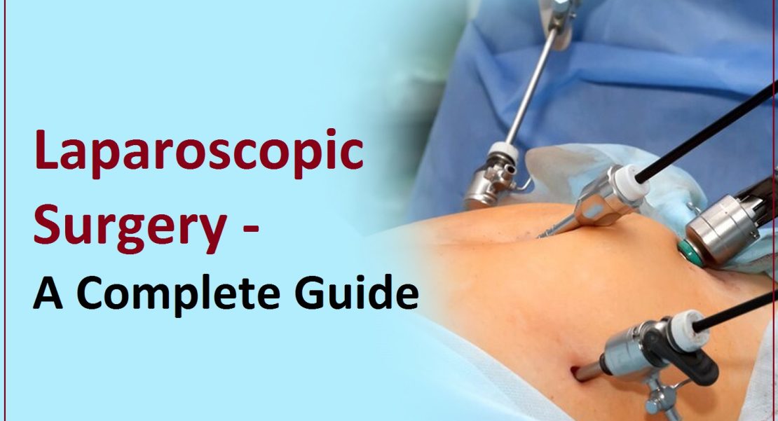 Laparoscopic Surgery in Varanasi