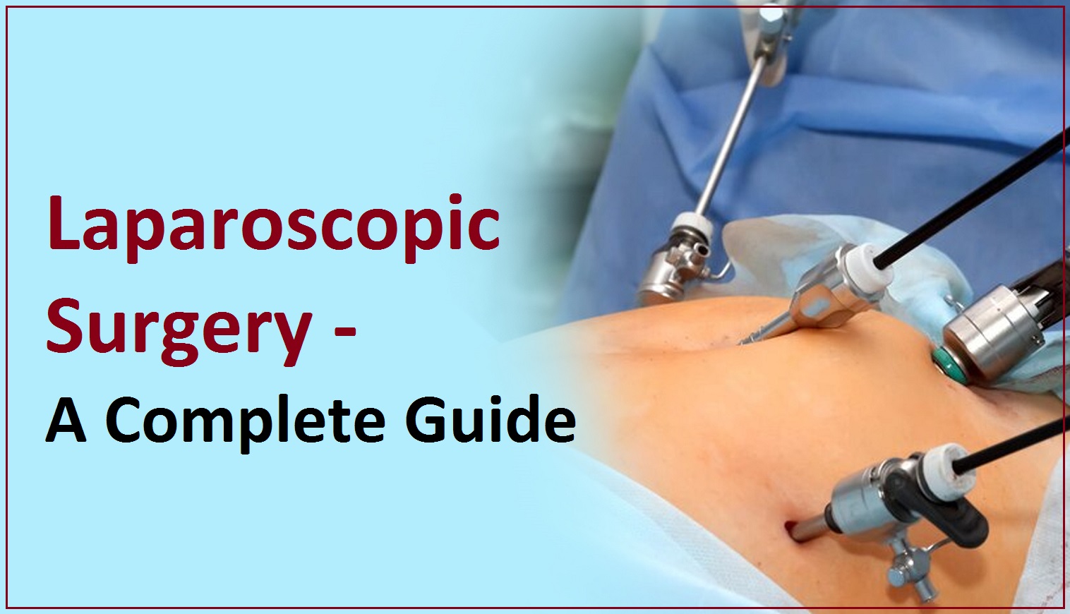 Laparoscopic Surgery in Varanasi