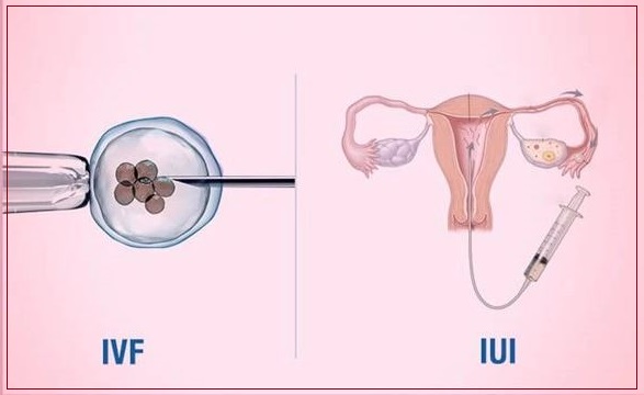 ivf treatment in varanasi