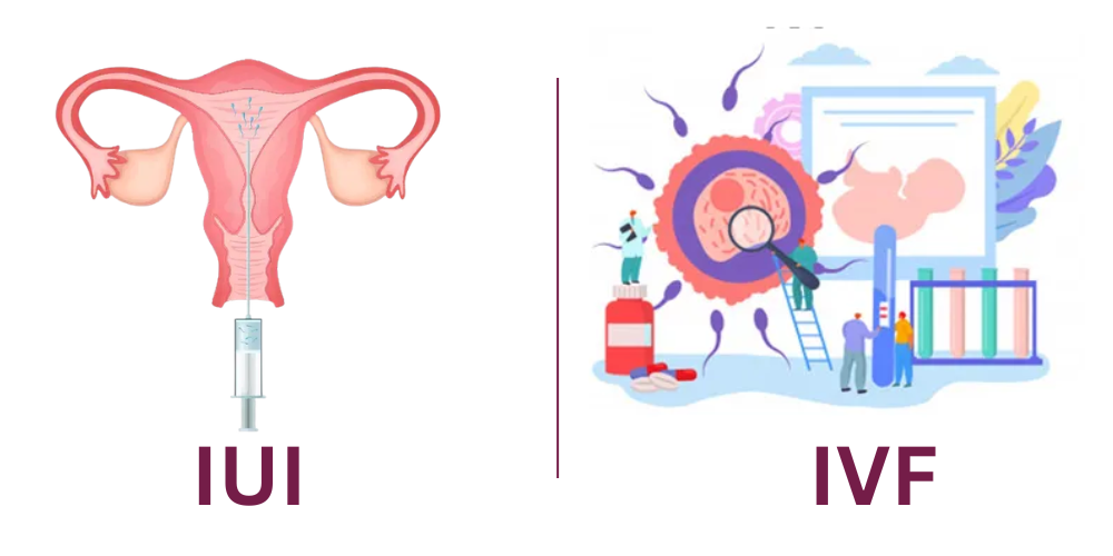 IVF and IUI